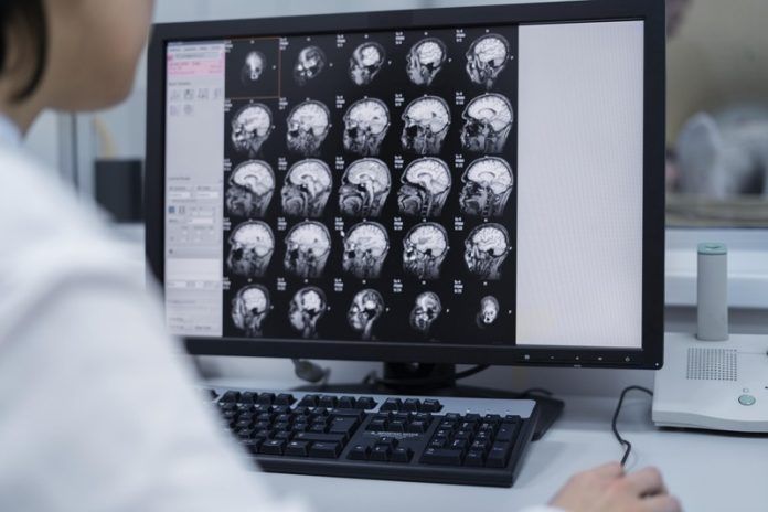 New ultrasonic skull treatment for severe resistant depression my health Images of a skull under ultrasonic treatment against resistant or even severe depression.