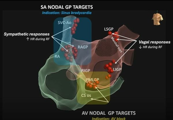SA NODAL GP TARGETS SA NODAL GP TARGETS