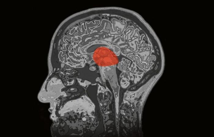 The thalamus, the cradle of consciousness?
