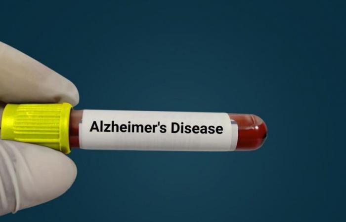A blood test allows diagnosis of the disease