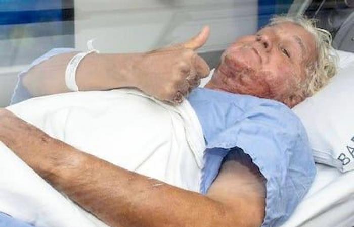 Jay Leno minimizes his many recent injuries: “People are injured all the time in real trades”