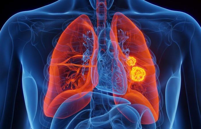 a new molecule to fight against metastases resistant to treatments