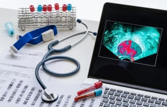 A polygenic score for prostate cancer screening | The doctor’s daily life | Specialties