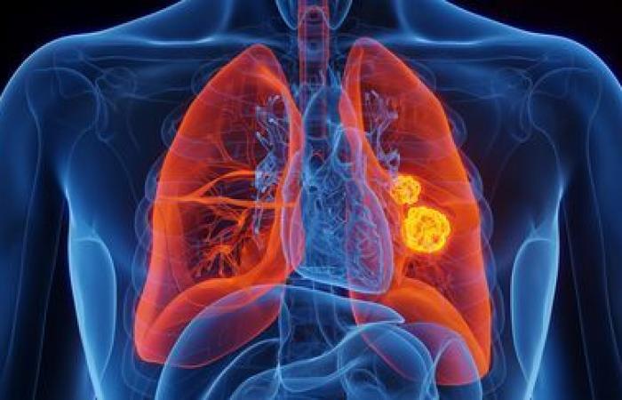 a new molecule to fight against metastases resistant to treatments
