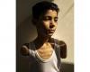 The portrait of an amputated Palestinian child wins the World Press Photo