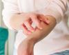 Dermatology: atopic eczema, let’s dare to talk about it!