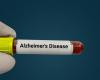 A blood test allows diagnosis of the disease