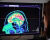 a new track to treat depression thanks to ultrasound