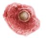 Zona vaccination would decrease cardiovascular risk | The doctor’s daily life | Specialties