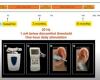 Is the vagal electrostimulation of the atrial tragus effective in the treatment of ventricular alien?