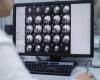 New treatment without medication?