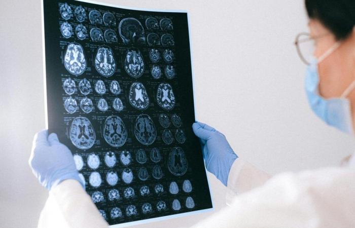 This revolutionary test that can detect early signs of dementia