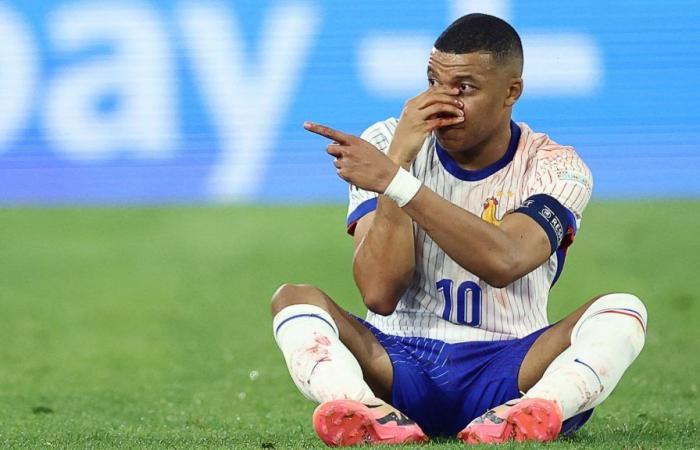 France – Austria: Is Mbappé’s nose injury serious?