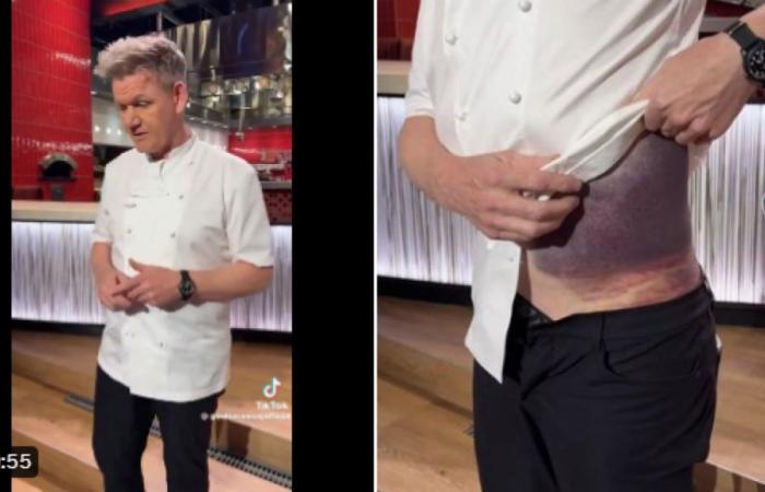 Shock, helmet, hematoma: chef Gordon Ramsay recounts his serious bicycle accident