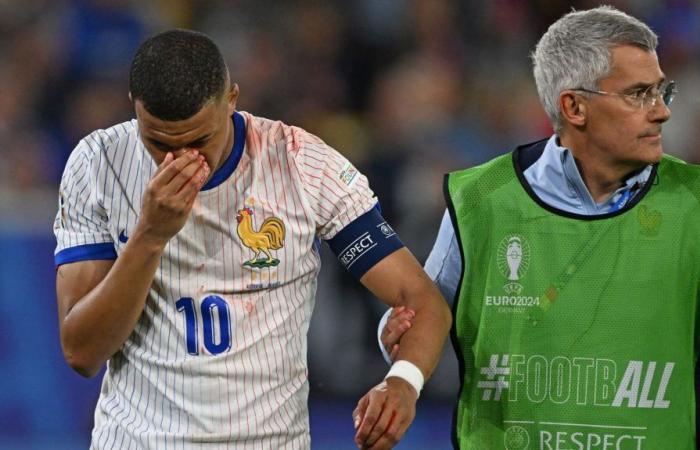 Broken nose for Kylian Mbappé, the rest of his tournament in danger?