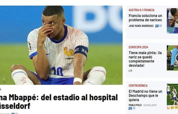 “Suffering and blood”, Mbappé’s nose on the front page of the international press