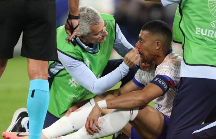 Euro finished for Mbappé? The worrying announcement from the ex-Blues doctor