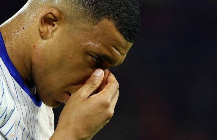 Kylian Mbappé invites Internet users to be creative after his broken nose