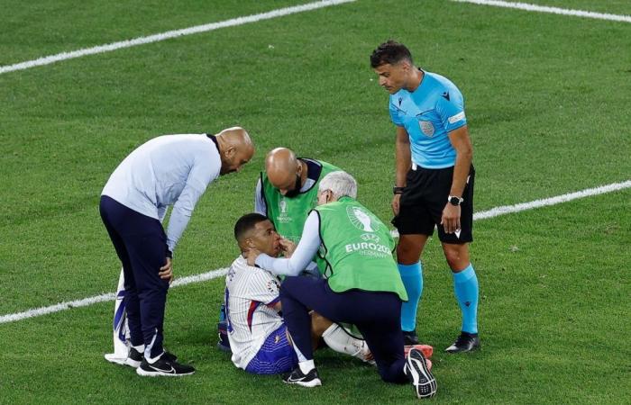 Euro 2024: Kylian Mbappé suffers from a broken nose