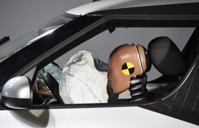 Defective airbags: the ordeal of Raïssa, disfigured by an explosion