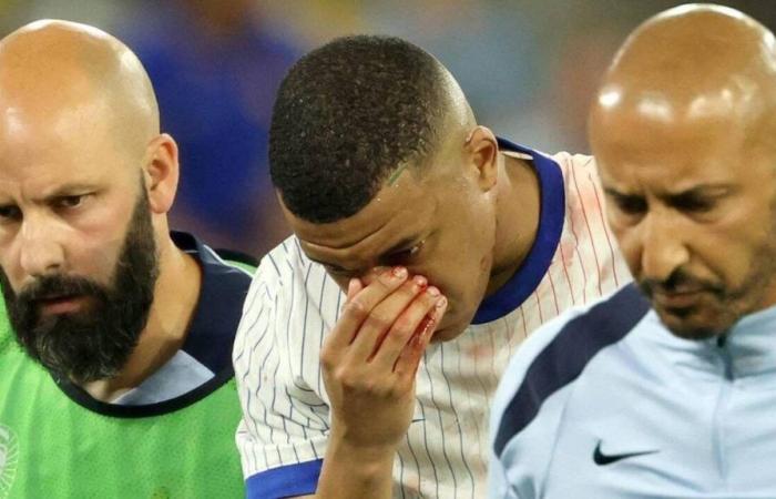 INTERVIEW. Former France team doctor provides update after Mbappé’s broken nose