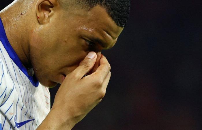 Mbappé’s broken nose: diagnosis, period of unavailability, mask… What we know about his injury