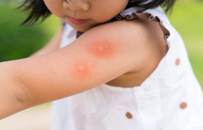 here is the best mosquito repellent to use, according to UFC-Que Choisir