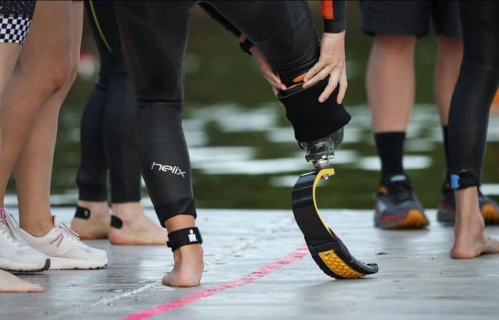 Better
      support
      for
      prostheses
      thanks
      to
      skin
      grafts
      becomes
      possible