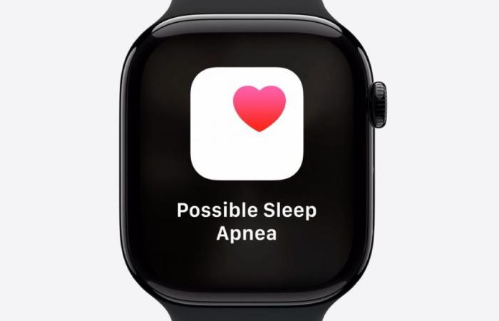 Sleep
      Apnea
      Detection
      Will
      Be
      on
      Apple
      Watches
      Soon.
      Here’s
      How
      It
      Will
      Work