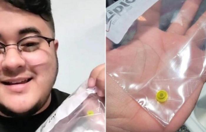 Man
      With
      Breathing
      Problems
      Since
      He
      Was
      6
      Discovers
      He
      Has
      Lego
      Stuck
      In
      His
      Nose