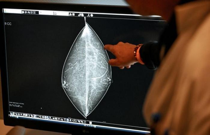 No symptoms, fear of diagnosis… when the brakes on breast cancer screening also slow down healing in Cantal