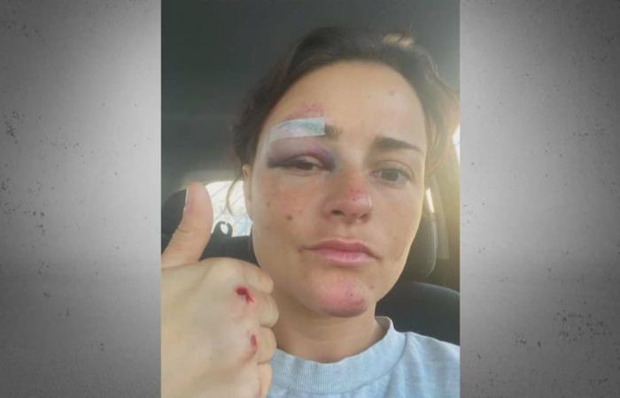 Hit by a motorcycle during the Montreal Marathon, she demands answers