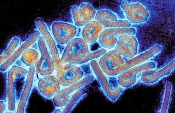 Ebola-like Marburg virus linked to 8 deaths in Rwanda