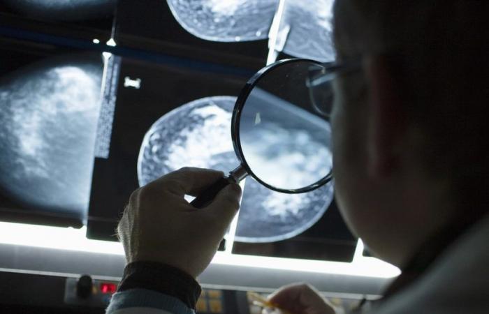 Breast tumors are smaller in cantons with screening