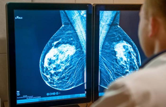 Increase in the number of cases of breast cancer among women under 50