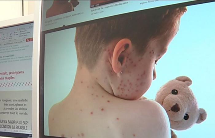 a cluster reported in unvaccinated children, health authorities warn of the dangers of this very contagious disease