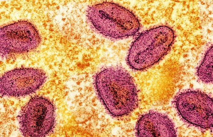 Ghana reports first case of smallpox, but variant not yet known