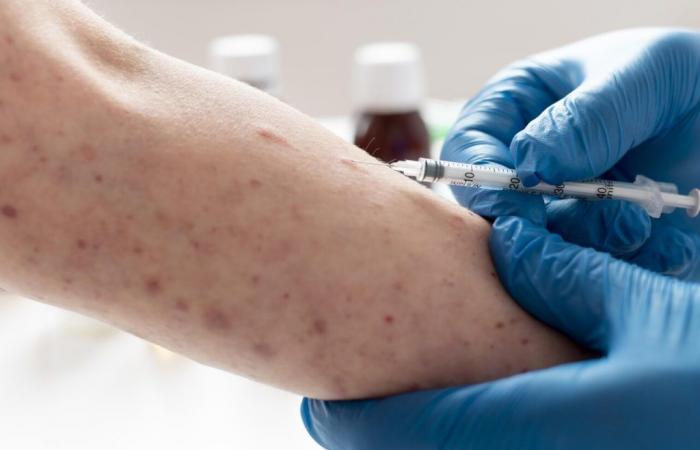 11 cases of measles detected in this town in Occitanie, for the ARS they have one thing in common