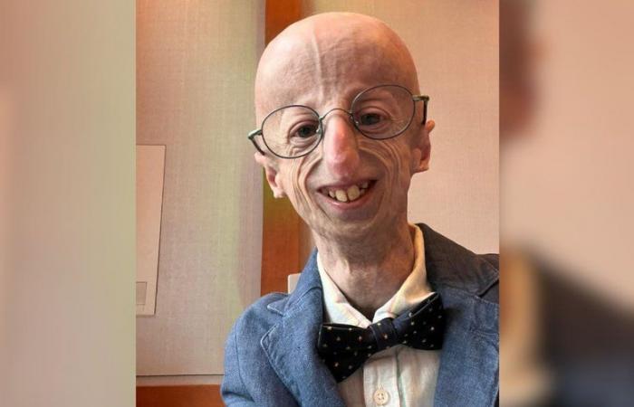 Sammy Basso, the oldest patient in the world suffering from premature aging, died at the age of 28