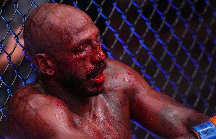 Khalil Rountree Jr. suffered several gruesome cuts at UFC 307, transported to hospital after fight