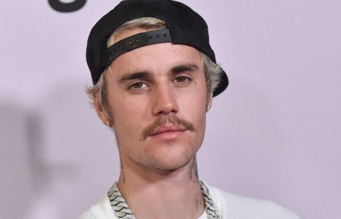 Justin Bieber at his worst since P. Diddy’s arrest, he lost a lot of weight