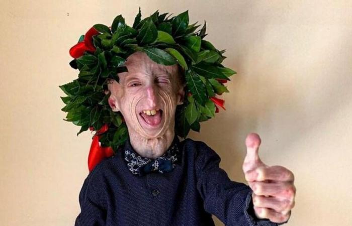 Sammy Basso, the longest-living progeria patient in the world, has died