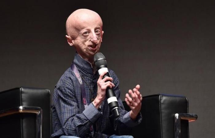 Sammy Basso died, he made progeria known – News