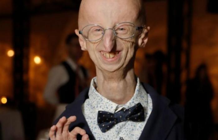 Sammy Basso, the oldest patient in the world suffering from premature aging, died at 28