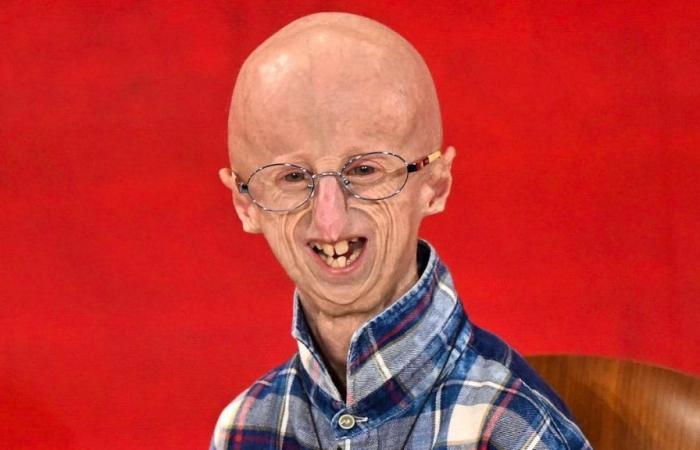 Sammy Basso is dead: progeria sufferer dies at the age of 28