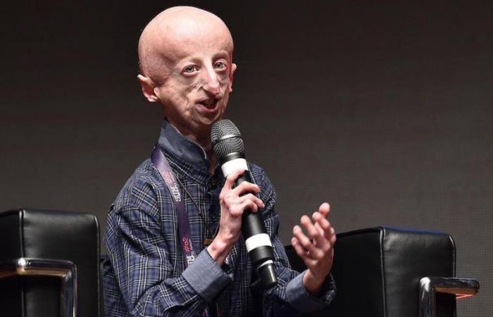 What is progeria – The Post