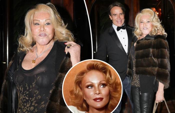 ‘Catwoman’ Jocelyn Wildenstein steps out after pre-surgery photo