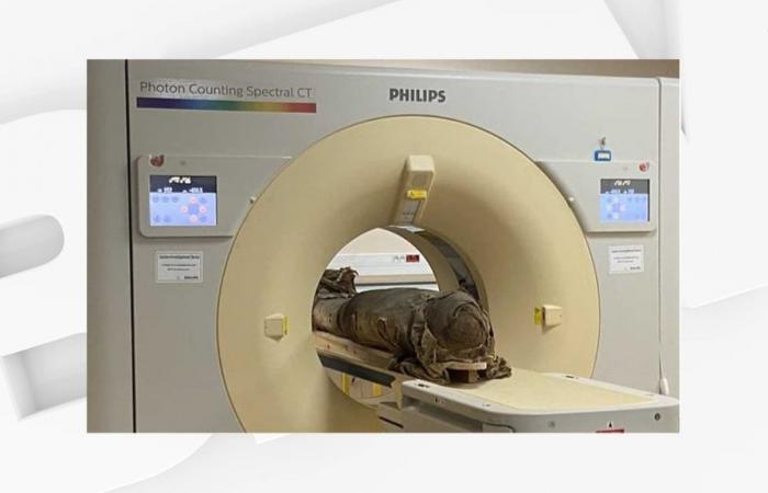 A 3,000-year-old mummy underwent a scanner in a Lyon hospital