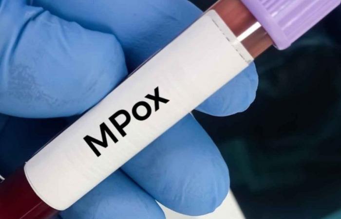 Mpox: Siga will provide the treatment in Morocco