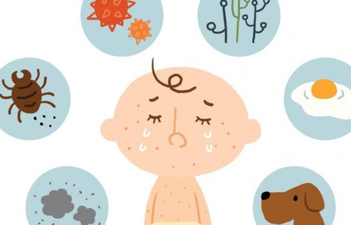 Pollution, diet, genetics: why are allergies exploding?